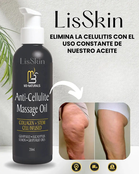 LisSkin - Despidete de la celutis con nuestro tratamiento en semanas